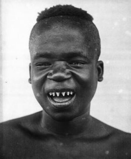 I "denti di pantera" di Ota Benga, limati secondo la tradizione tribale - Immagine presa dal web, immagine utilizzata per uso di critica o di discussione ex articolo 70 comma 1 della legge 22 aprile 1941 n. 633