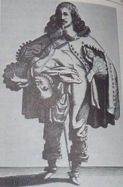 Gemelli siamesi inglobati - Immagine utilizzata per uso di critica o di discussione ex articolo 70 comma 1 della legge 22 aprile 1941 n. 633, fonte Internet